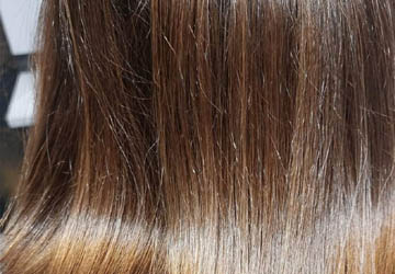 Badanie trychologiczne Zielona Góra