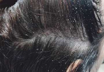 Zielona Góra trycholog Nitecka